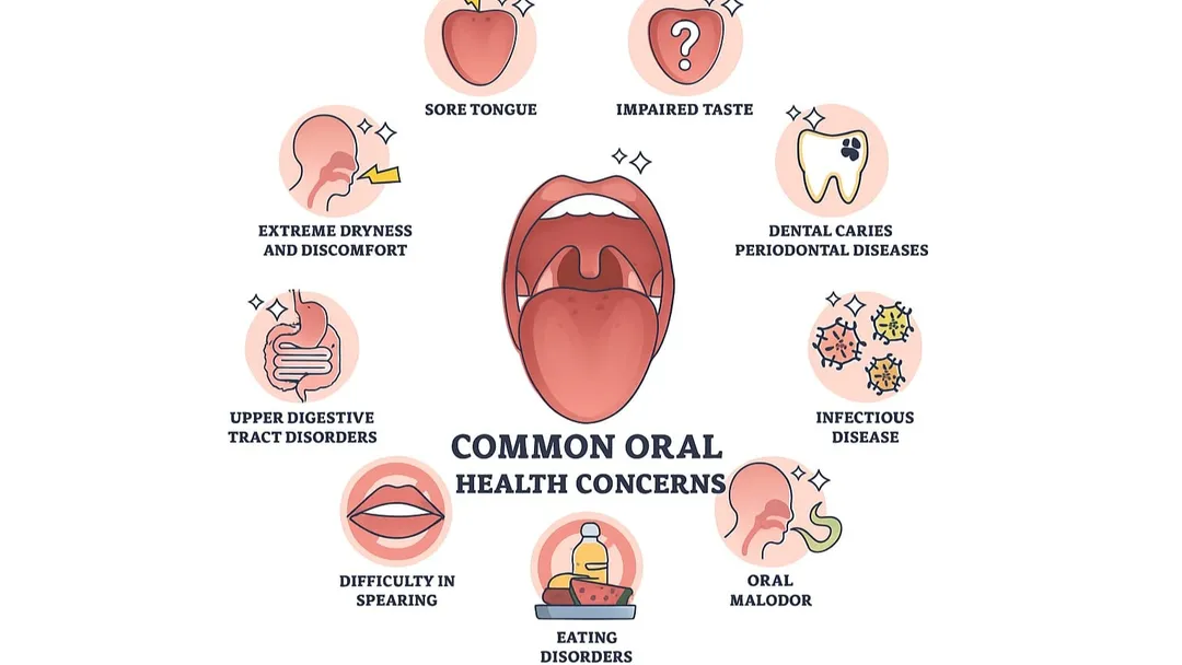 COMMON ORAL HEALTH CONCERNS 